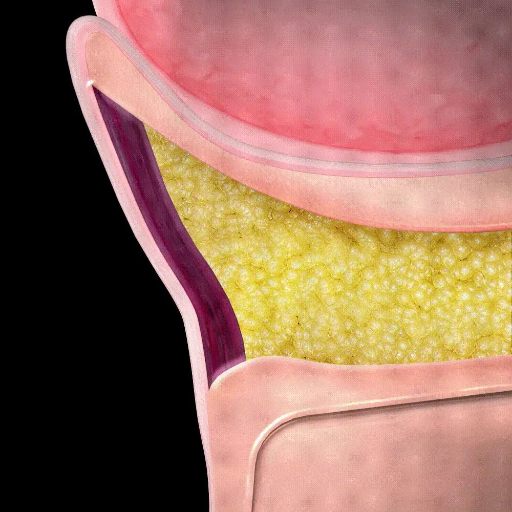 [아이백볼륨UP] 성분에디터 실크펩타이드 인텐시브 리프팅 아이크림 30ml 더블기획 상세페이지 26
